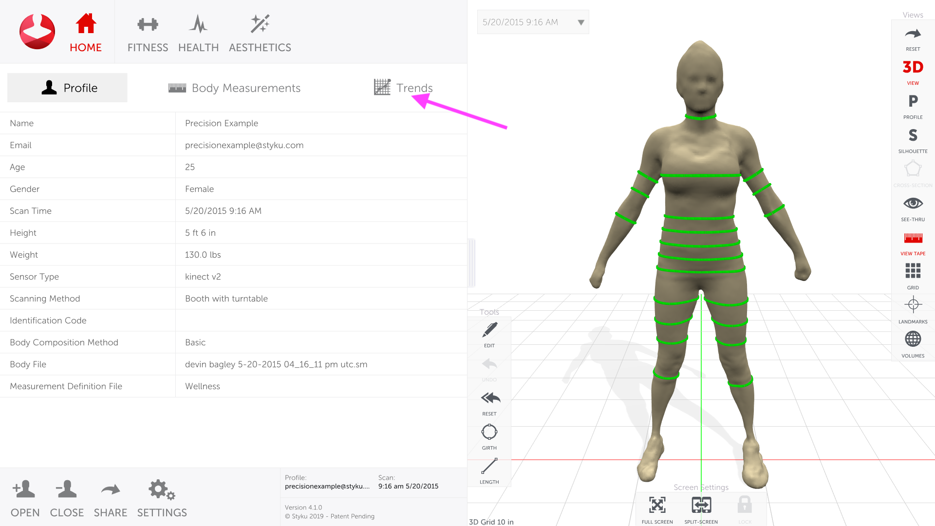 How can I check the precision/repeatability of Styku's measurements?